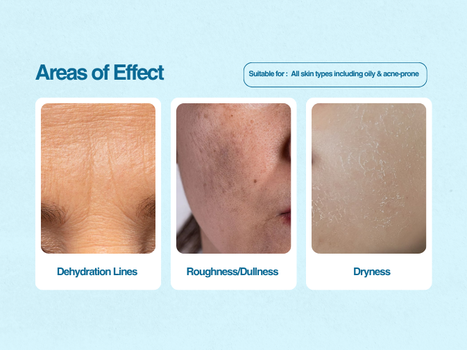 HYDRATE Weightless Oil-Free Moisturiser - Image 6