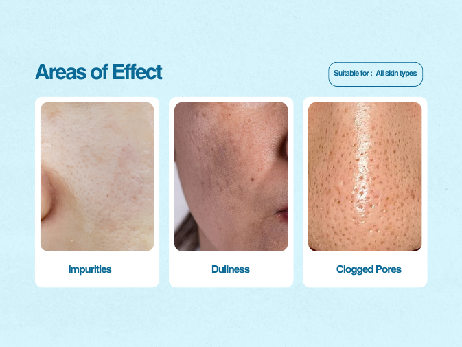 CLEANSE Sulphate-Free Purifying Face Wash - Image 6